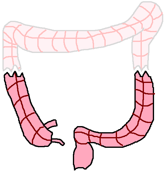 Semi Colon